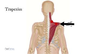 Trigger points of trapezius [upl. by Bonn]