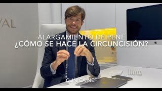 ¿COMO SE HACE LA CIRCUNCISIÓN ¿MERECE LA PENA [upl. by Amada505]