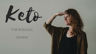 KETO for ROSACEA  Day 30 [upl. by Lahtnero762]