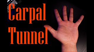 Do You have CARPAL TUNNEL [upl. by Chancellor]