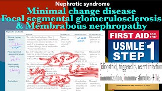 Minimal change disease Focal segmental glomerulosclerosis amp Membranous nephropathy in HindiUrdu [upl. by Shelly]