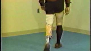 Gait deviations relating to a transtibial prosthesis [upl. by Ramon601]