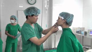 Genioplasty surgeryChin surgery [upl. by Grindle]