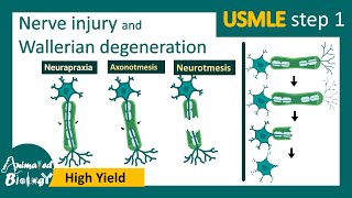 Nerve injury  Wallerian degeneration  Mechanism of wallerian degeneration  USMLE [upl. by Henig]