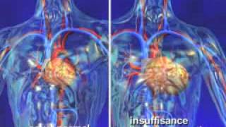 Insuffisance cardiaque dépistage de l’insuffisance cardiaque en vidéo santé 3D [upl. by Lawtun]