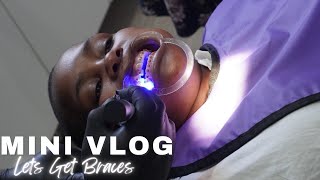 Vlog Lets go get braces  Braces Installation Brace Vlog Lunch South African YouTuber [upl. by Ennaeus161]