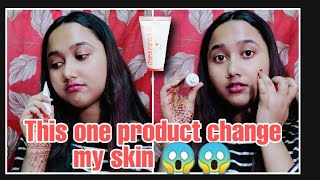 This One Product Change My Skin Issues  Erytop Cream For Acne n Pimple Skin [upl. by Whorton527]