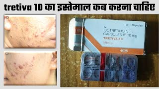 Tretiva 10 mg Capsule Uses  Isotretinoin Uses side Effects amp Dose In Hindi tretiva 10 mg benefits [upl. by Rosalynd]