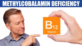 The 1st Sign of a Methylcobalamin B12 Deficiency [upl. by Ailimat]