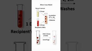 Cross match labtechnician medicallabtechnician biology science medicallaboratorytechnician [upl. by Mirabelle]