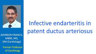 Infective endarteritis in patent ductus arteriosus [upl. by Flossy]