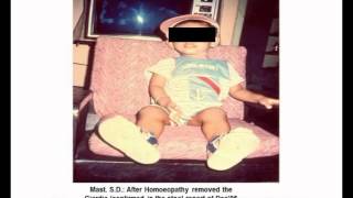 Giardia with Mucus Stool cured by Homeopathy GA011 [upl. by Arinaid]