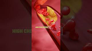 कोलेस्ट्रॉल कैसे बढ़ता है How Cholesterol Affects Your Body Explained with ANIMATIONshorts [upl. by Forest]