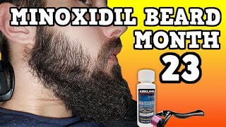 Minoxidil Beard Growth Results  Month 23  TheJourneyContinues [upl. by Siloam238]