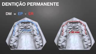 Discrepância de Modelo [upl. by Osei]