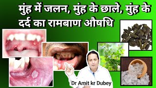 Muh ke Ander Jalan  Muh ke chale Muh ke Dard ka Rambaan upay । Mouth ulcer treatment dramitkdubey [upl. by Charissa]