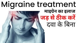 Migraine ka ilaj  Migraine treatment at home in Hindi [upl. by Kristy]