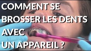 Comment se brosser les dents avec un appareil dentaire  Appareildentaireinfo [upl. by Ynohtnakram]