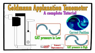 Goldmann Applanation Tonometer  Complete Tutorial [upl. by Diba]