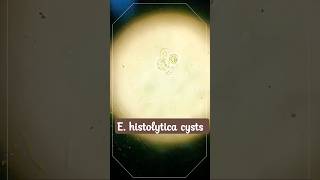 E histolytica cysts  Amoebiasis [upl. by Fowler]