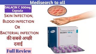 Dalacin C 300mg Capsule  Skin infection or Bacterial infection की सबसे अच्छी दवाई  How To Take [upl. by Katrinka982]