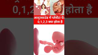 Pregnancy Ultrasound me Placenta Grade 0123 kya hota hai shorts pregnancy placenta pregnant [upl. by Aryek767]