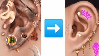 Cleaning Piercing BlackheadsEar Pus Removal Satisfying Video  gentleglam asmr [upl. by Nuawd]