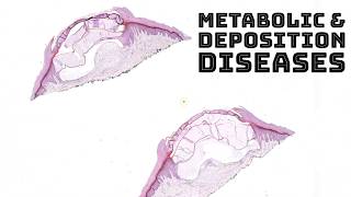 Metabolism amp Deposition Diseases in Skin dermatology dermpath pathology board review [upl. by Edgardo181]