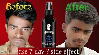 muuchstac face wash 7 day result not side effect rewive muuchstacfacewash [upl. by Peh]