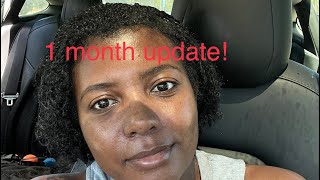 Ethnic Rhinoplasty 1 Month Update [upl. by Trometer]