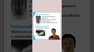 Osteíte Condensante  Características Clínicas e Radiográficas  Resumo Concurso Odontologia [upl. by Boj]