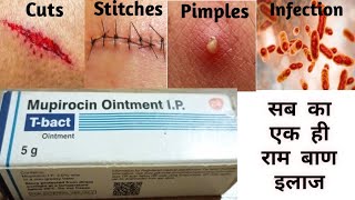 Mupirocin ointment  T bact ointment  mupirocin ointment ip uses in hindi l t bact cream [upl. by Eenyaj]