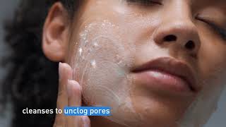 Clear Acne and Prevent New Breakouts │ CeraVe Skincare [upl. by Siryt]