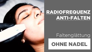 Radiofrequenz ANTI FALTEN im Gesicht schmerzfrei ohne OP [upl. by Yves]