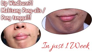 Lip Windburn Remedy  Easy And Affordable Remedy [upl. by Lawan210]