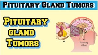 pituitary adenoma pathology [upl. by Hahcim]