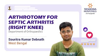 Arthrotomy for Septic Arthritis Right Knee Yashoda Hospitals Hyderabad [upl. by Ahsata758]