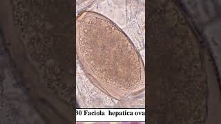 amazing parasites ova and their names parasitology microscope [upl. by Feola]