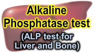 Alkaline phosphatase test  ALP test for liver and bones  ALP test [upl. by Ethelinda310]