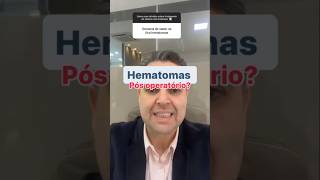 Hematomas no tratamento de varizes [upl. by Emelita]