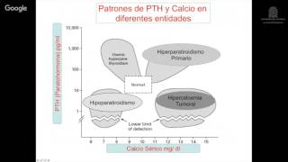 Hiperparatiroidismo primario [upl. by Osicnarf]