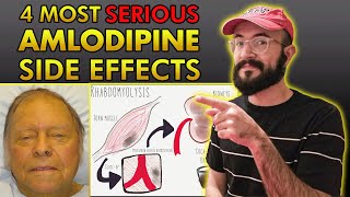 4 Most SERIOUS Amlodipine Side Effects [upl. by Etram]