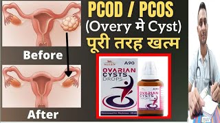 Ovarian cyst  ओवरी में गांठ  PCOD  without operation homeopathic dwaAllen A90 Ovarian Cysts Drop [upl. by Fabrianne]