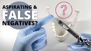 What Most Dentists Dont Know About Aspirating  OnlineExodontiacom [upl. by Libby959]