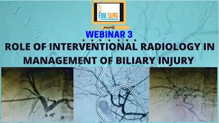 Interventional Radiology in biliary injury management Dr Rahul Sheth Safe cholecystectomy webinar [upl. by Paule]