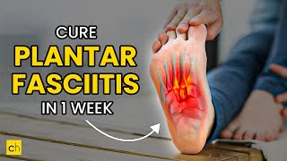 How To Cure Plantar Fasciitis in One Week  Credihealth plantarfasciitis exercise footpain [upl. by Quinn452]