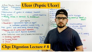 Ulcer Disease peptic ulcer  Causes symptoms and Treatments [upl. by Ilajna]