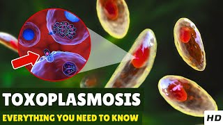 Toxoplasmosis – Causes Signs and Symptoms Diagnosis amp Treatment [upl. by Larentia]