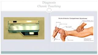 Pediatric compartment syndrome [upl. by Kered]