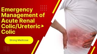 Emergency Management of Acute Renal Colic  Ureteric Colic  Nephrolithiasis [upl. by Bassett]